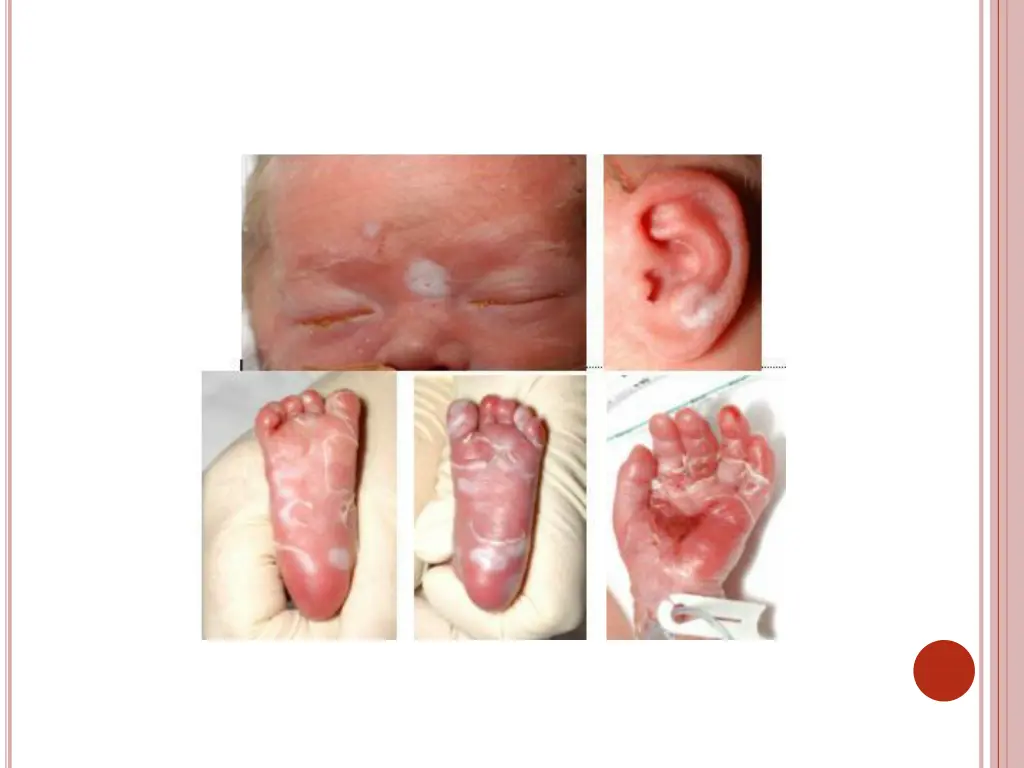 slide38