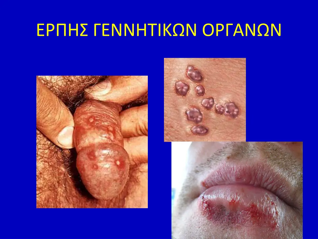 slide42