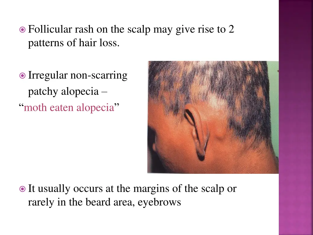 follicular rash on the scalp may give rise