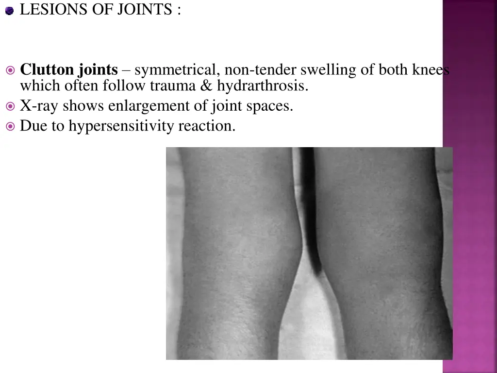 lesions of joints