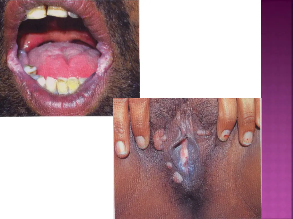 slide28