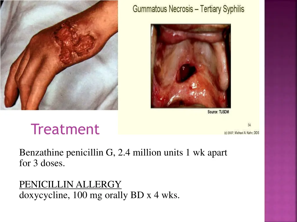 treatment 2