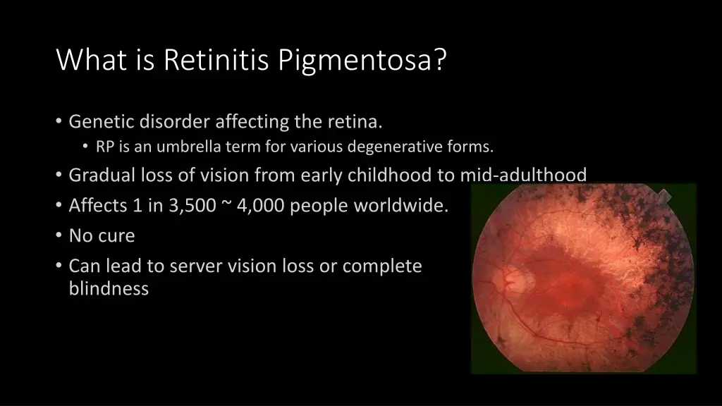 what is retinitis pigmentosa