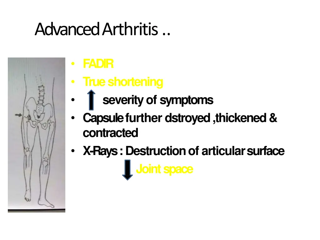 advanced arthritis