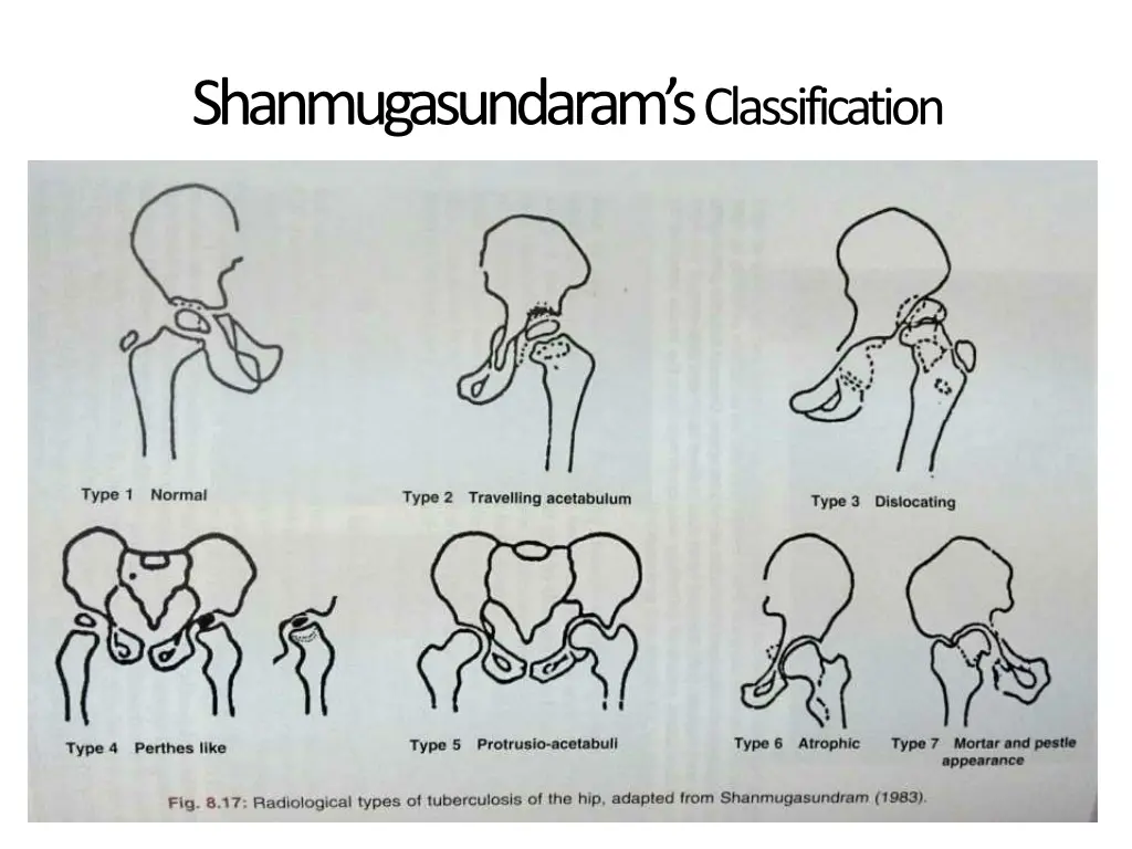 shanmugasundaram s classification