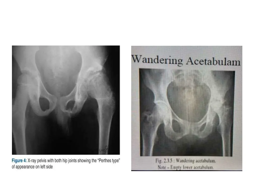 slide27