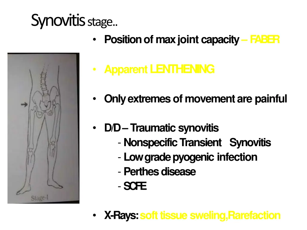 synovitis stage