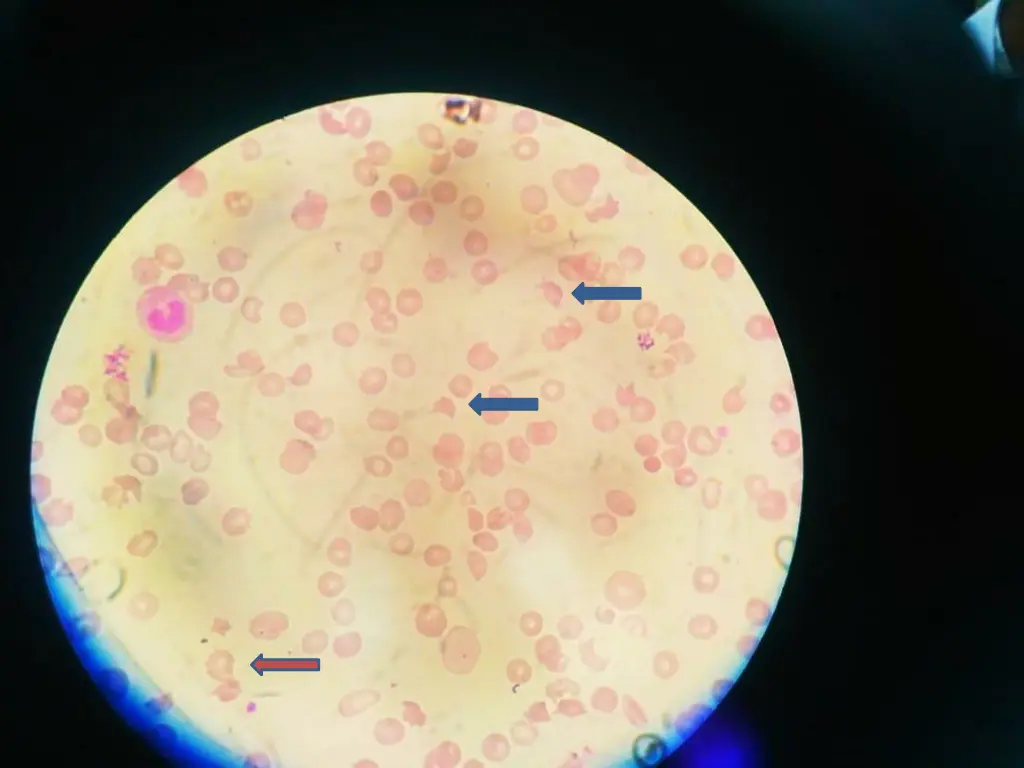 slide11