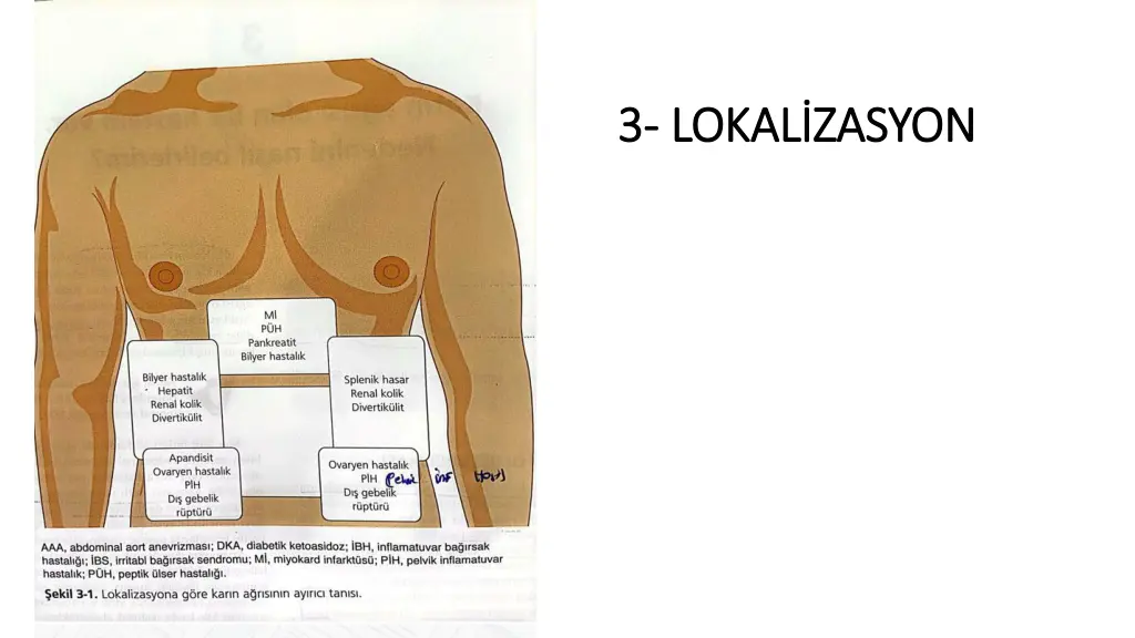 3 3 lokal zasyon lokal zasyon