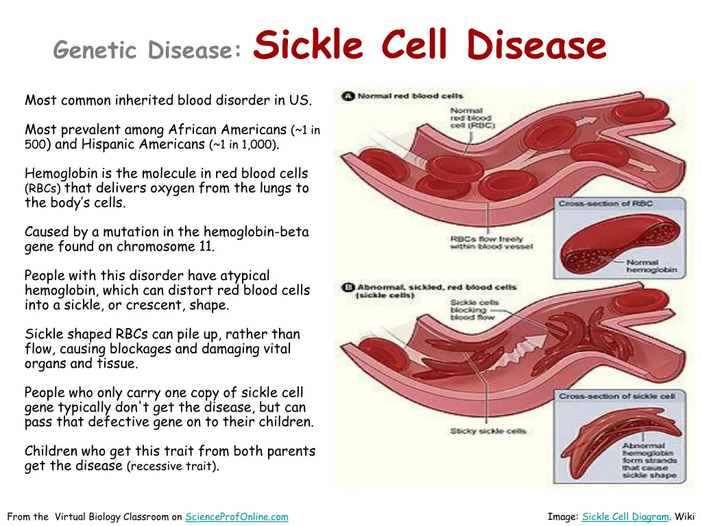 genetic disease sickle cell disease
