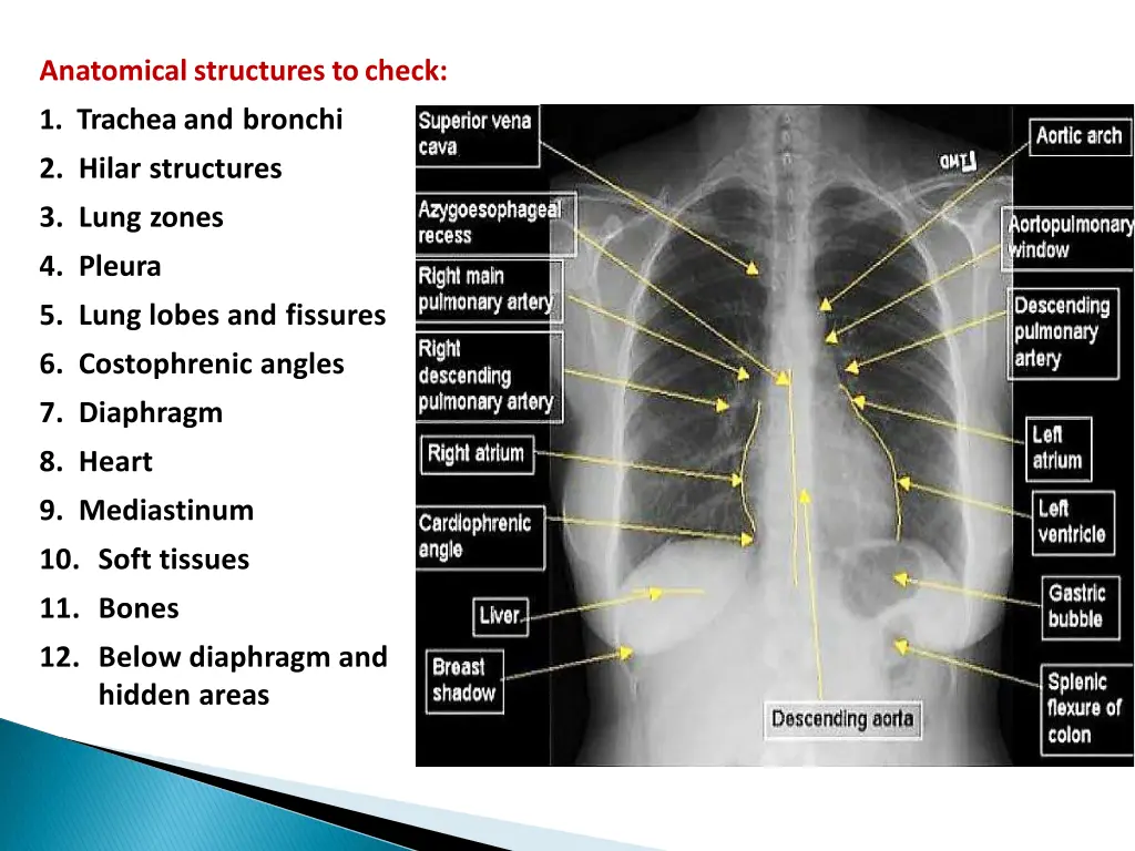 anatomical structures tocheck