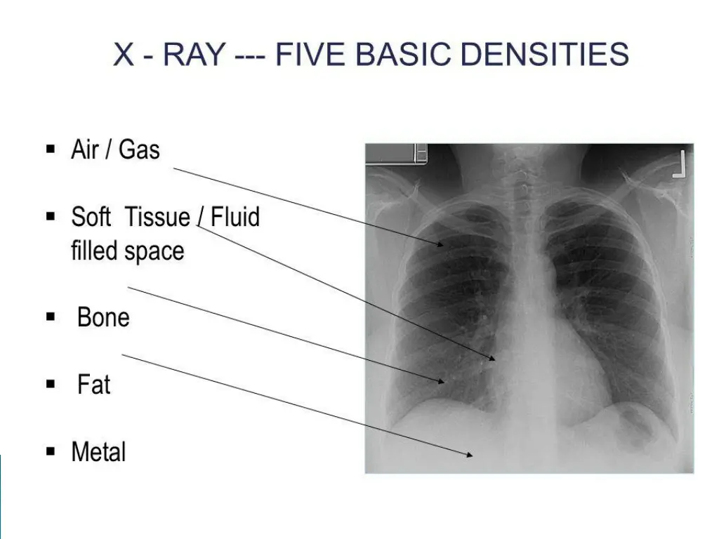 slide15