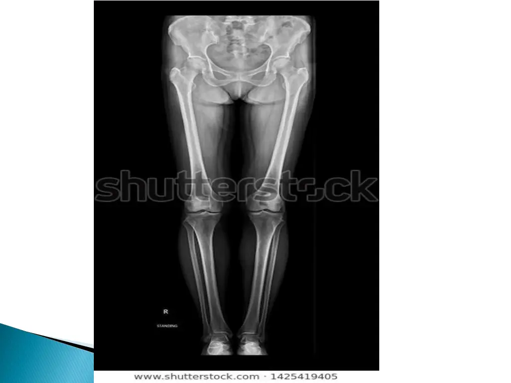 slide21