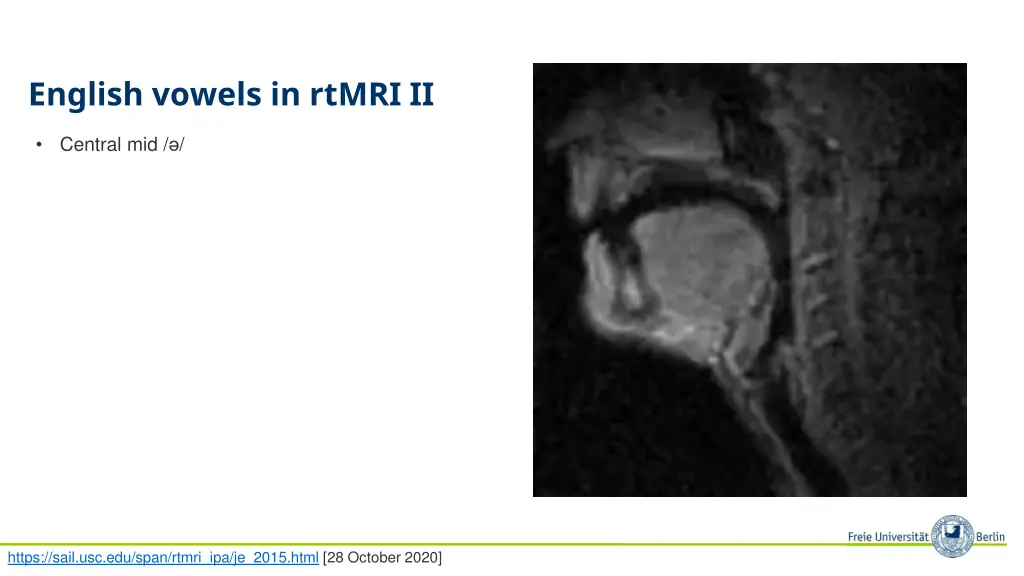 english vowels in rtmri ii