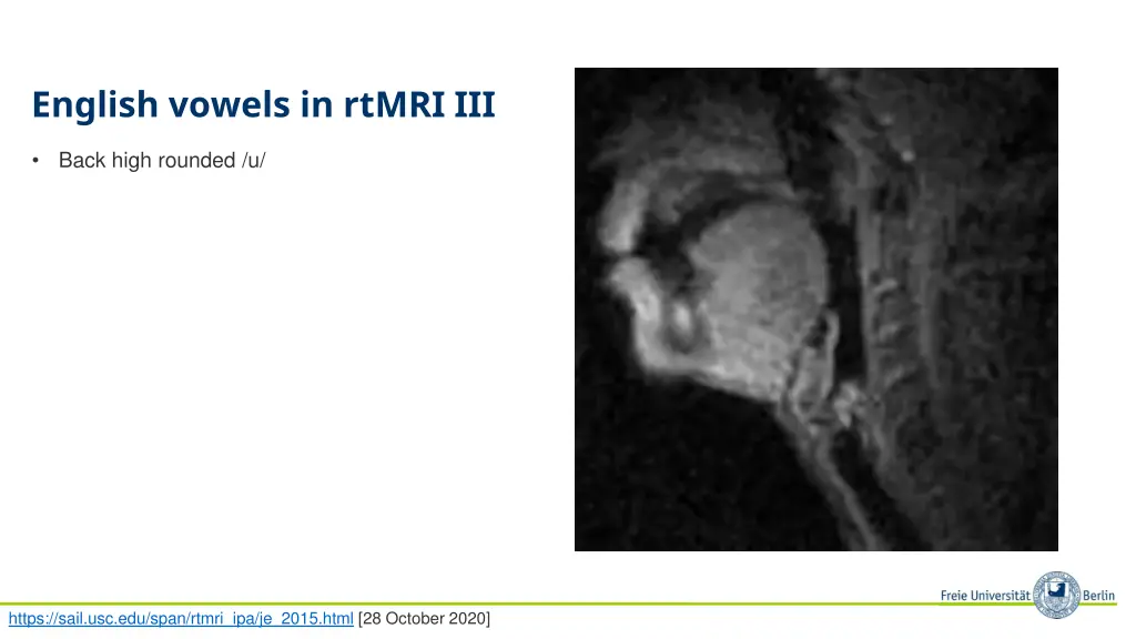 english vowels in rtmri iii