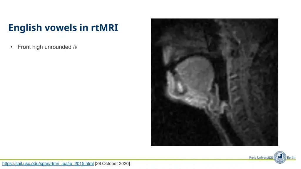 english vowels in rtmri
