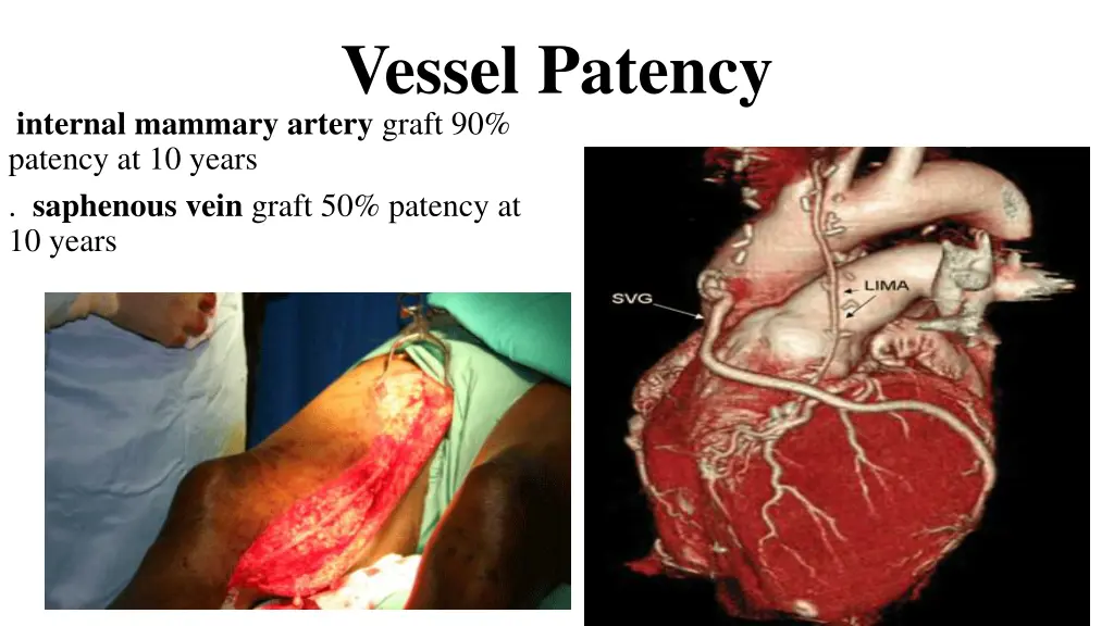 vessel patency