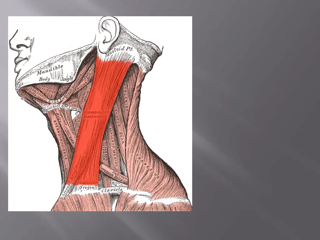 slide14