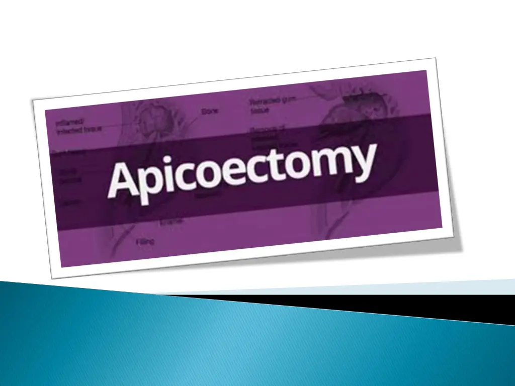 slide2
