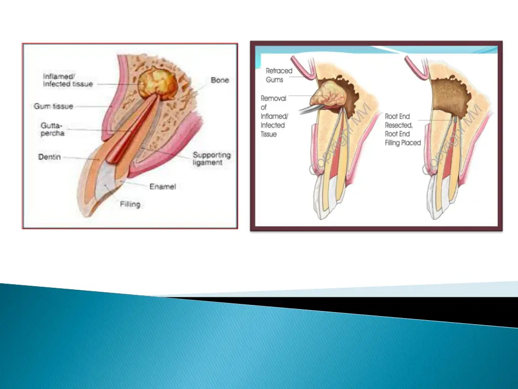 slide4