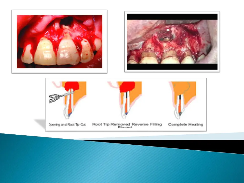 slide5