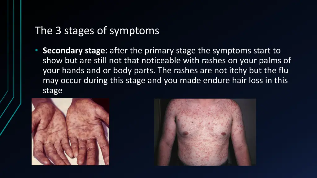 the 3 stages of symptoms 1