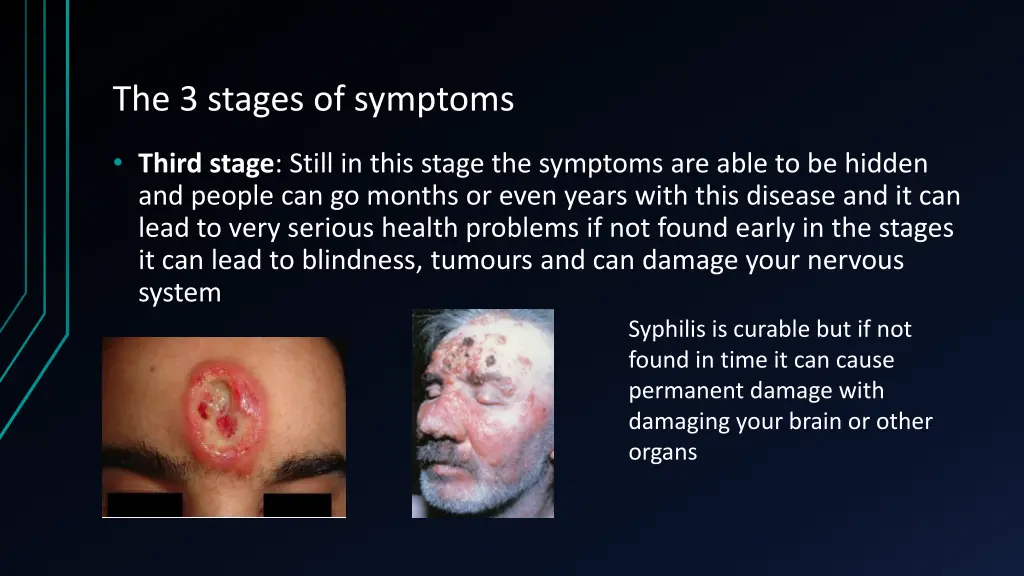 the 3 stages of symptoms 2