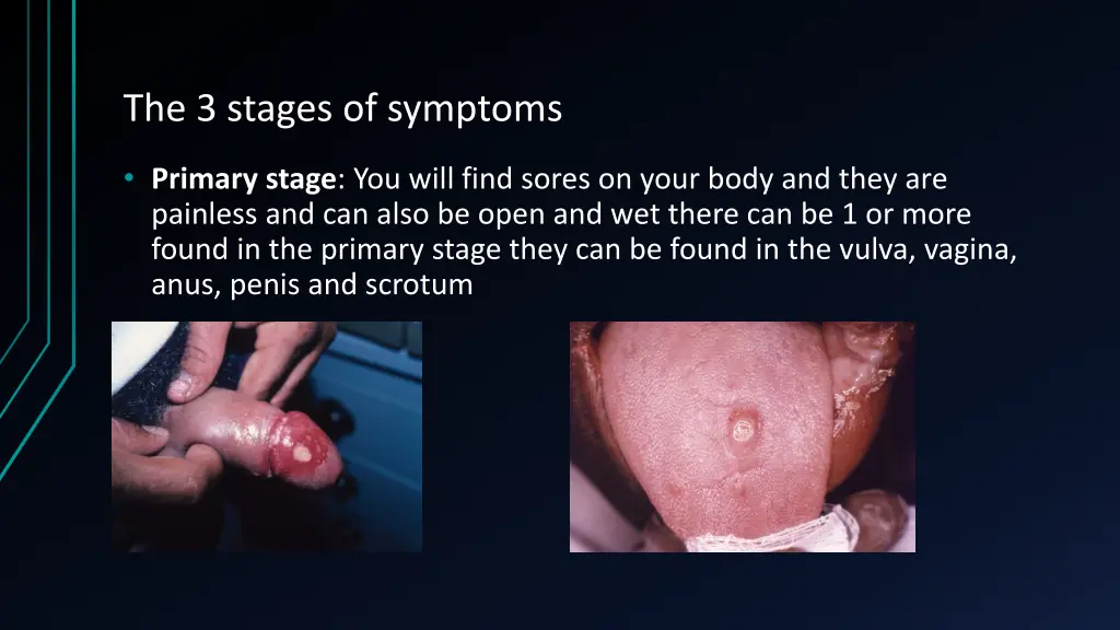 the 3 stages of symptoms