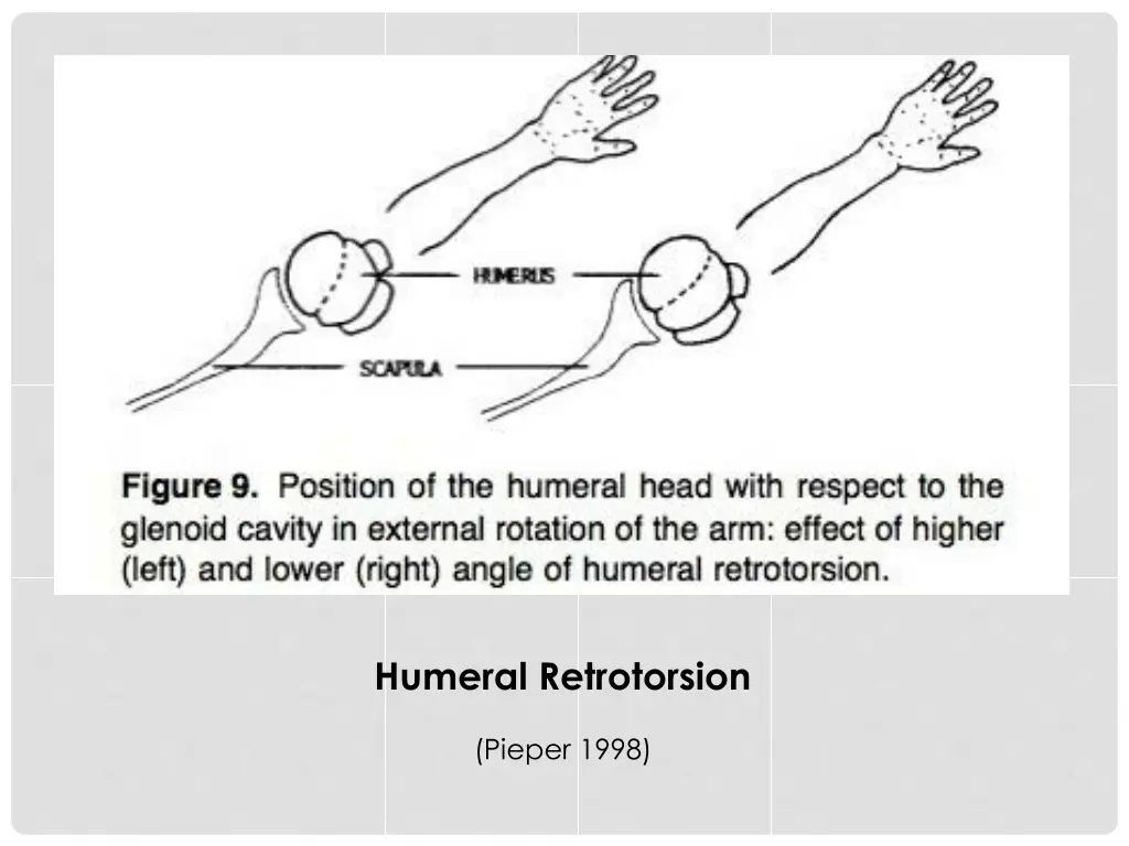 humeral retrotorsion