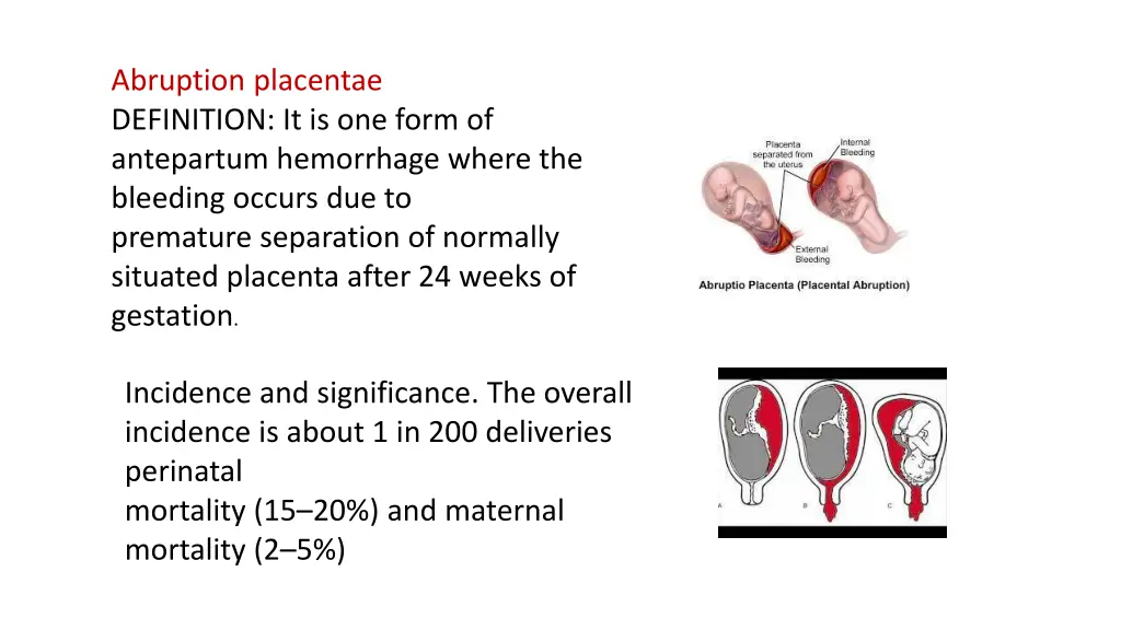 abruption placentae definition it is one form