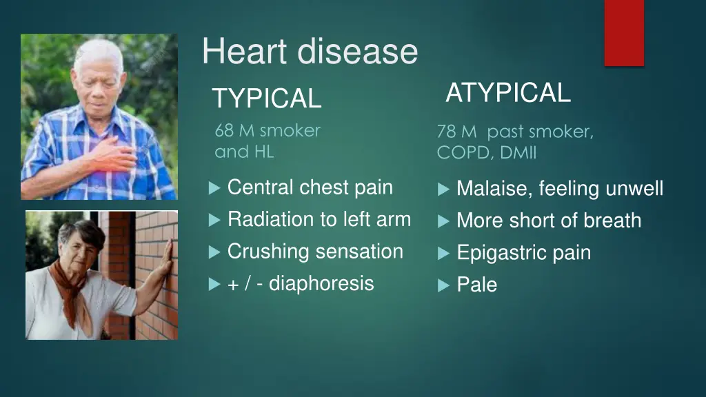 heart disease typical