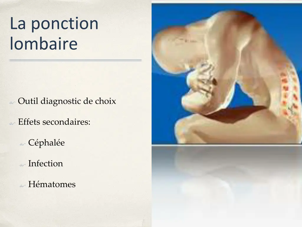 la ponction lombaire
