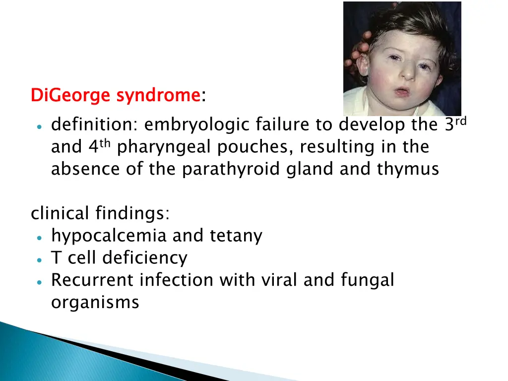 digeorge definition embryologic failure