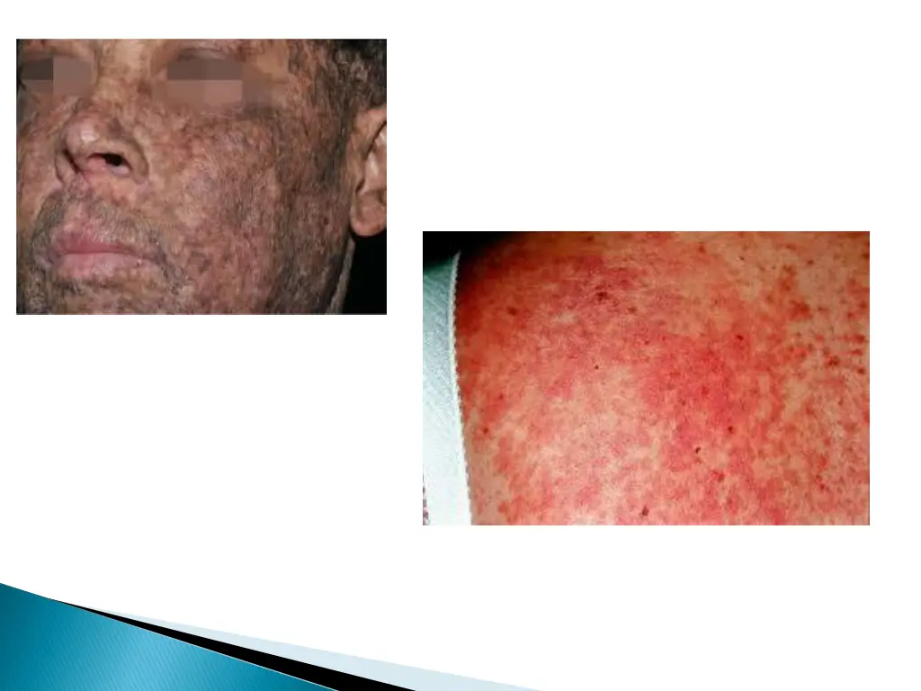 slide9