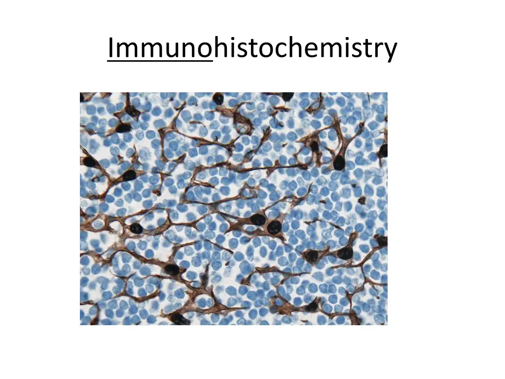 immunohistochemistry