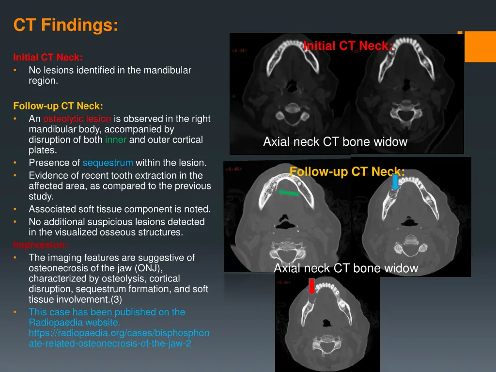 ct findings