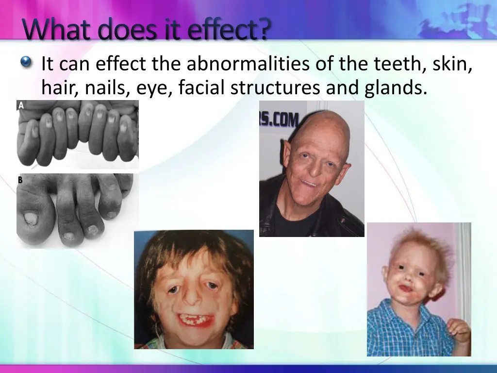 what does it effect it can effect