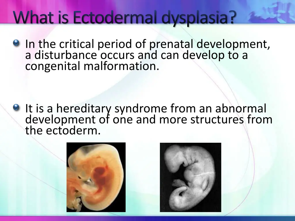 what is ectodermal dysplasia