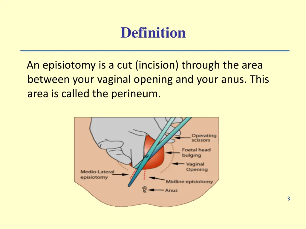 definition