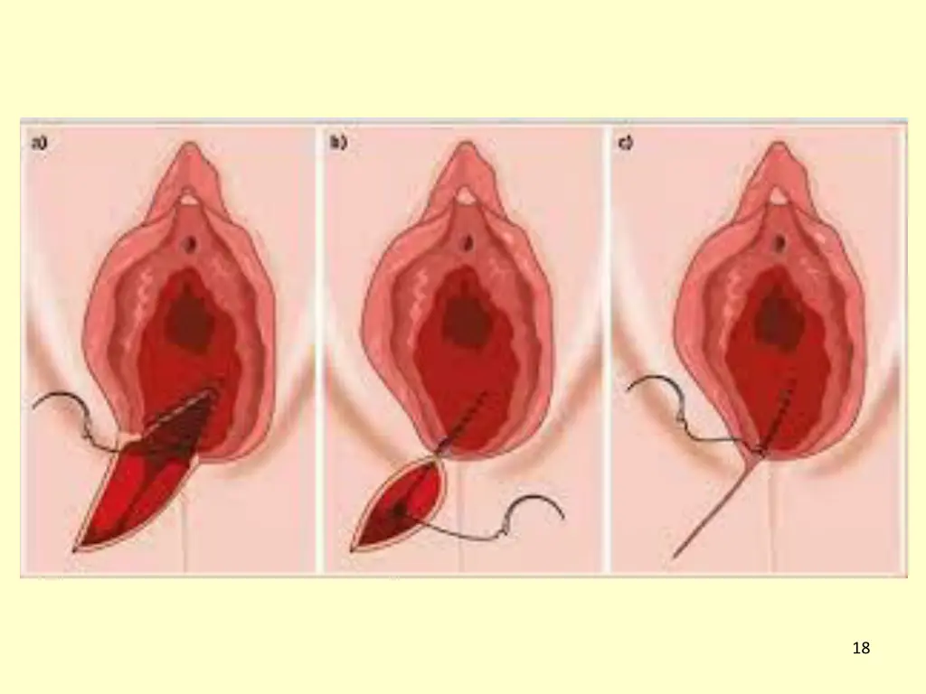 slide18