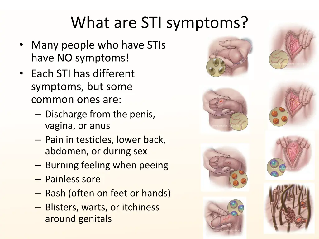 what are sti symptoms many people who have stis