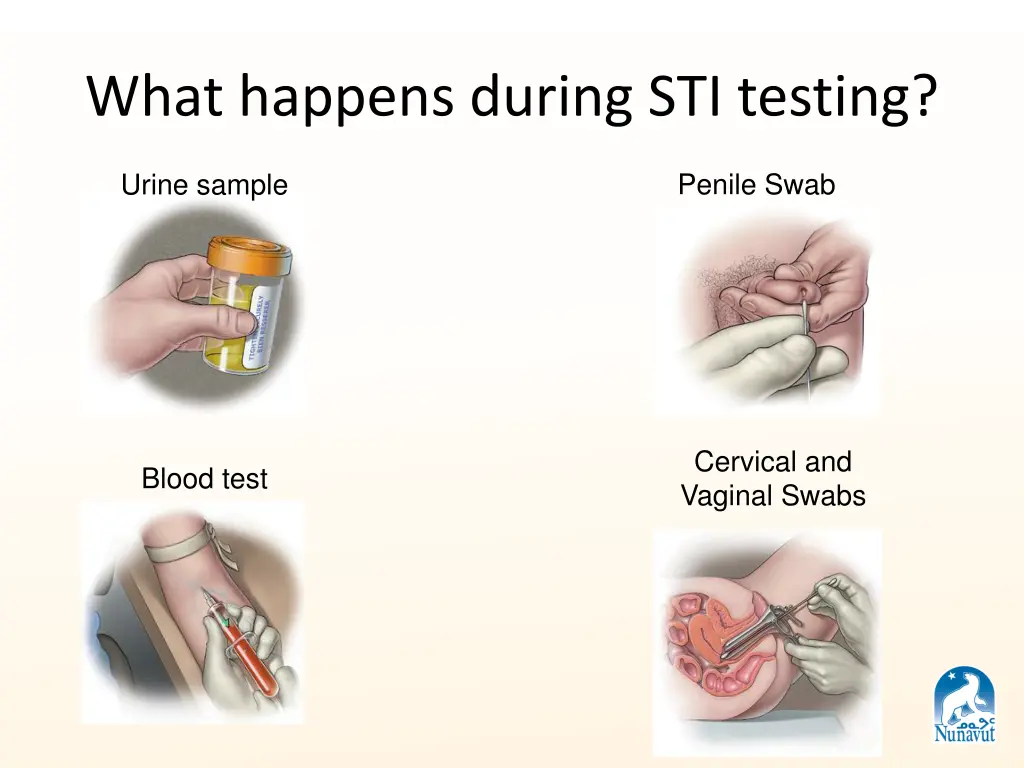 what happens during sti testing