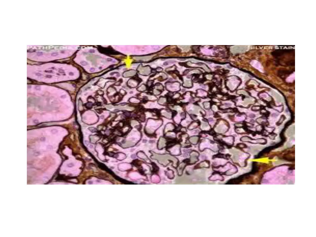 slide26