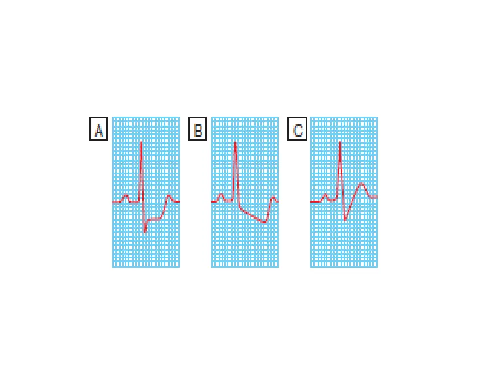 slide12