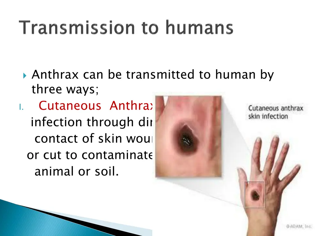 anthrax can be transmitted to human by three ways