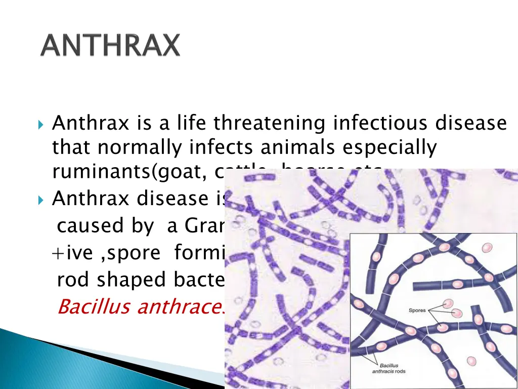anthrax is a life threatening infectious disease