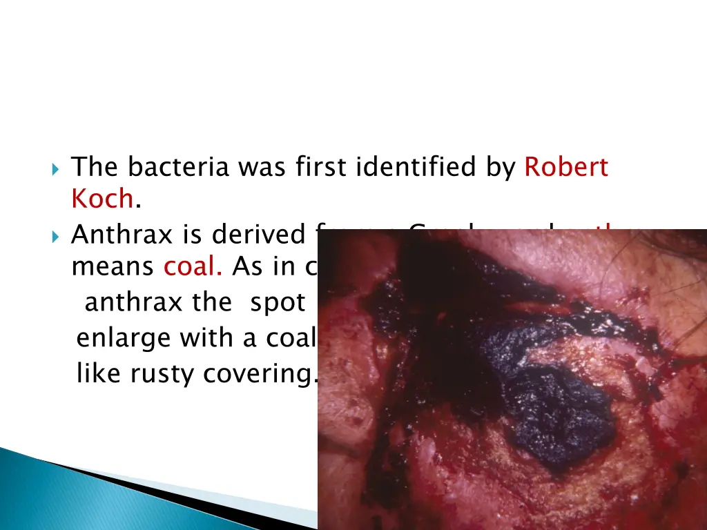 the bacteria was first identified by robert koch