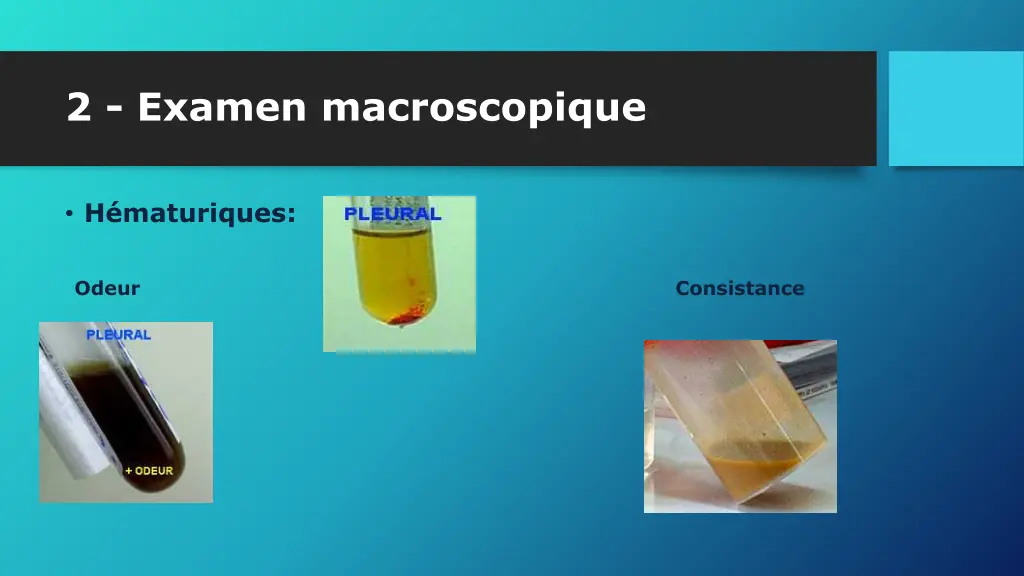2 examen macroscopique 1
