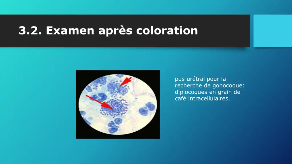 3 2 examen apr s coloration 1