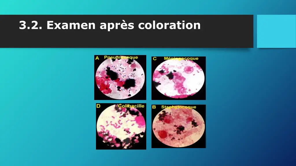3 2 examen apr s coloration 3